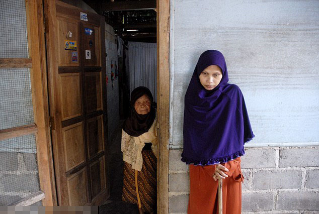 女子全身僵直不能弯曲 生活靠90岁祖母照顾(图)