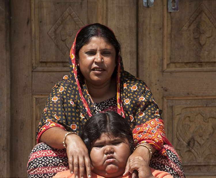 9岁,女孩,体重,180斤 