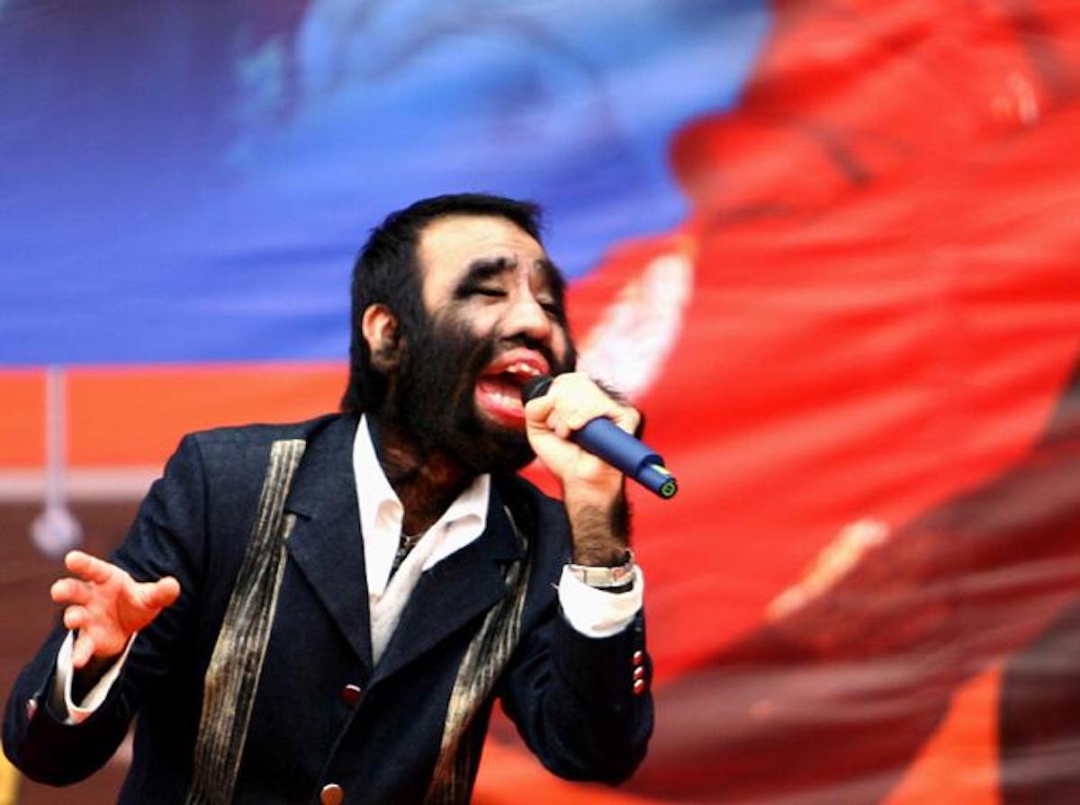 【中国第一毛孩】中国第一毛孩曾数度想自杀 如今能歌善舞