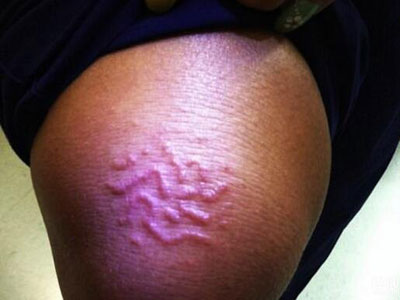 比基尼美女躺沙滩竟遭活虫钻入体内:惊人一幕(图) 比基尼美女躺沙滩竟遭活虫钻入体内:惊人一幕(图)