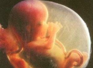 为啥胎儿在羊水里能睁开眼睛 胎儿在子宫都会做什么 为啥胎儿在羊水里能睁开眼睛 胎儿在子宫都会做什么