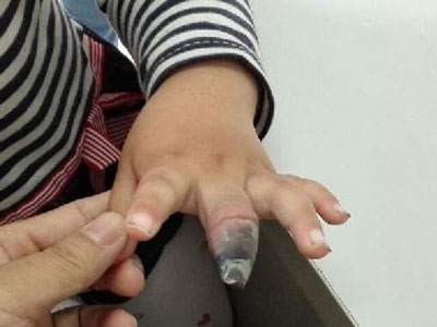 原来创可贴这样贴才正确! 原来创可贴这样贴才正确!