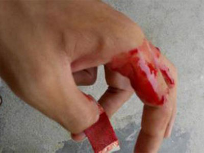 原来创可贴这样贴才正确! 原来创可贴这样贴才正确!