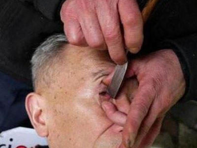 失传已久的古老技艺刀锋洗眼:你见过吗? 失传已久的古老技艺刀锋洗眼:你见过吗?