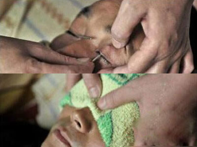 失传已久的古老技艺刀锋洗眼:你见过吗? 失传已久的古老技艺刀锋洗眼:你见过吗?