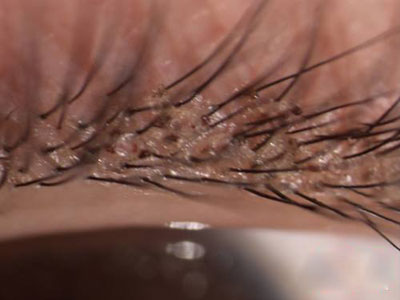 被窝这东西有多脏真相惊呆你 被窝这东西有多脏真相惊呆你