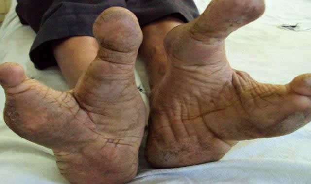 世界十大奇异民族：十大奇异民族的女人大盘点