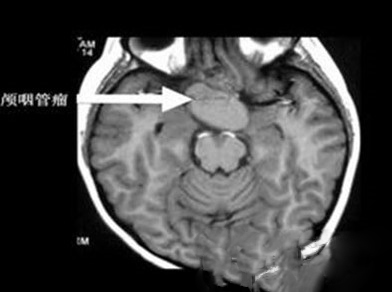 世上最奇怪的6大牙齿盘点：多长了232颗牙齿的少年
