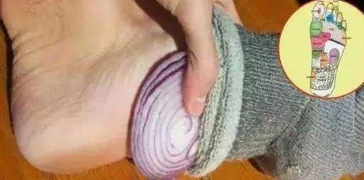 洋葱的功效与作用：女子把洋葱切片放在脚底变化惊人