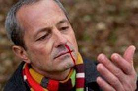 经常流鼻血并非偶然：经常流鼻血的原因需注意