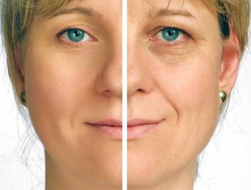 黑眼圈怎么办 ：淡化黑眼圈的五种秘密武器（图）