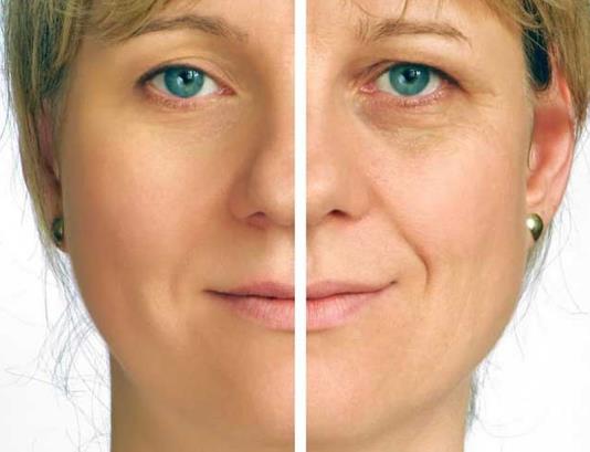 天生黑眼圈怎么办 教你如何淡化黑眼圈