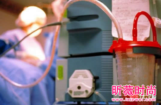 美国最新流行的吸血鬼隆乳:手术方式让人毛毛的 美国最新流行的吸血鬼隆乳:手术方式让人毛毛的