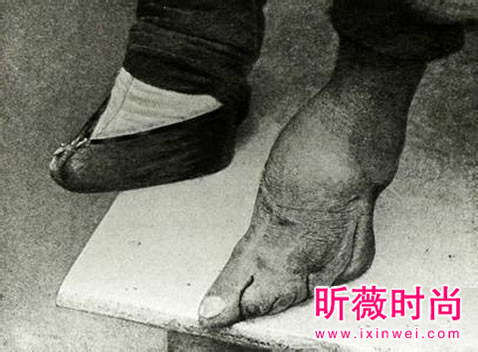 古代女子遭受的最痛苦酷刑：古代女子裹足过程残忍（图）
