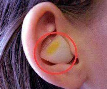 洋葱放入耳朵一夜奇迹出现了(图) 洋葱放入耳朵一夜奇迹出现了(图)