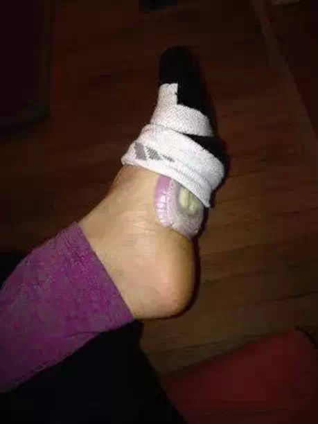 洋葱放入耳朵一夜奇迹出现了(图) 洋葱放入耳朵一夜奇迹出现了(图)