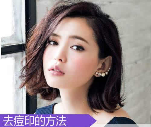 5招去痘印最有效的方法 可以还你无瑕疵美肌 5招去痘印最有效的方法 可以还你无瑕疵美肌