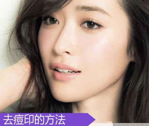 5招去痘印最有效的方法 可以还你无瑕疵美肌 5招去痘印最有效的方法 可以还你无瑕疵美肌