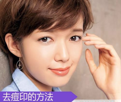 5招去痘印最有效的方法 可以还你无瑕疵美肌 5招去痘印最有效的方法 可以还你无瑕疵美肌