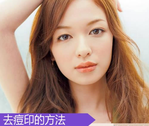 5招去痘印最有效的方法 可以还你无瑕疵美肌 5招去痘印最有效的方法 可以还你无瑕疵美肌