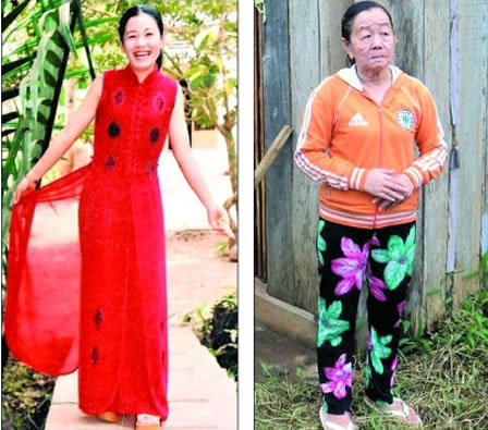 惊骇!26岁美女一夜衰老成老太：恍若隔世（图）