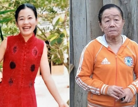惊骇!26岁美女一夜衰老成老太：恍若隔世（图）