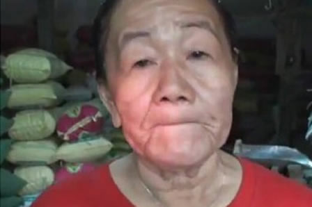 惊骇!26岁美女一夜衰老成老太：恍若隔世（图）