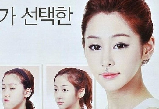 【什么是微笑手术】韩国流行的嘴部整形手术 【什么是微笑手术】韩国流行的嘴部整形手术
