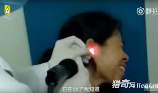 睡梦中被痛惊醒去医院竟取出它