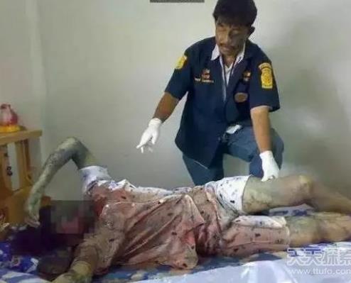 女子床上凄惨一幕!惊呆众人(上半身被烧焦发黑) 女子床上凄惨一幕!惊呆众人(上半身被烧焦发黑)