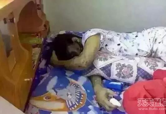 女子床上凄惨一幕!惊呆众人(上半身被烧焦发黑) 女子床上凄惨一幕!惊呆众人(上半身被烧焦发黑)