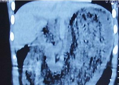 异食癖人玻璃石头汽油均在列 异食癖人玻璃石头汽油均在列