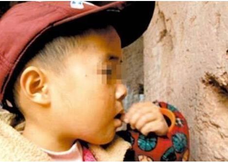 异食癖人玻璃石头汽油均在列 异食癖人玻璃石头汽油均在列