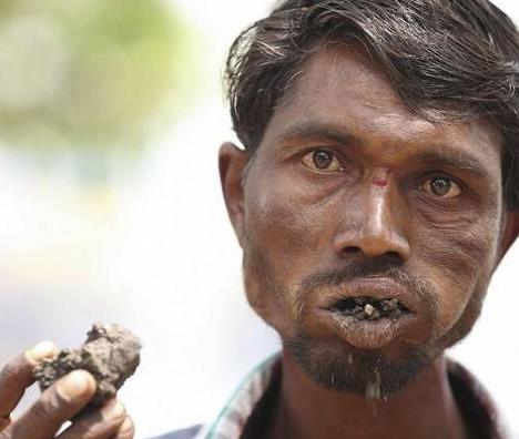 异食癖人玻璃石头汽油均在列