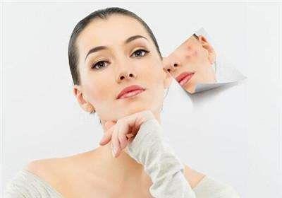 脸上有痘印怎么办 5个痘印怎么消除小妙招