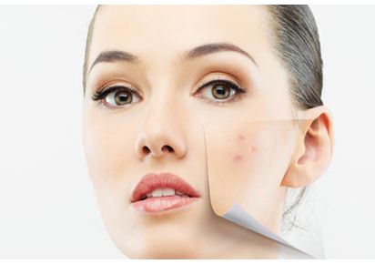 怎样快速祛痘消痘印?快速祛痘最有效的方法