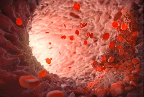 心脏血管堵塞吃它后变通畅了（图）