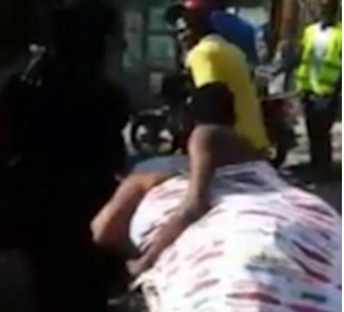 情侣开房亲热时下身卡住了：一辆板车送医尴尬画面