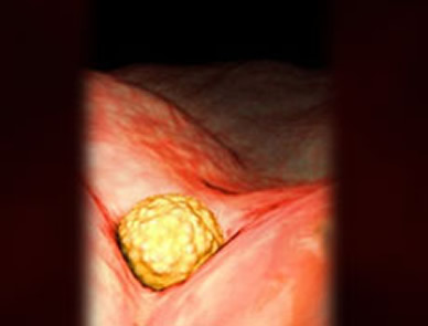 【怀孕4周】怀孕四周胎儿图，怀孕4周有什么反应及胎儿发育