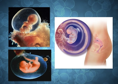 【怀孕8周】怀孕八周胎儿图，怀孕8周反应及胎儿发育情况