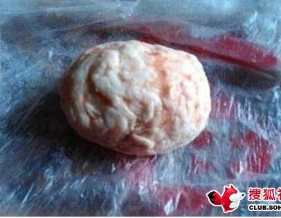 杀猪发现硬物:村民一夜暴富(图) 杀猪发现硬物:村民一夜暴富(图)