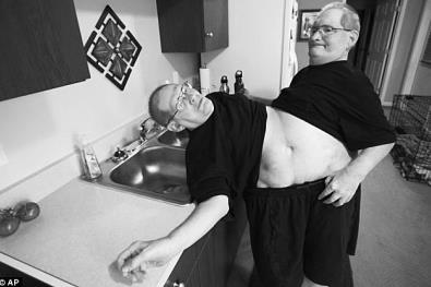 揭秘世界上最长寿的连体婴(图文) 揭秘世界上最长寿的连体婴(图文)