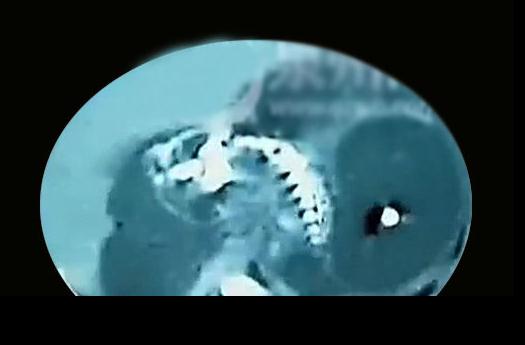 七个月男婴竟怀孕 剖腹产下一女婴:喊人听闻 七个月男婴竟怀孕 剖腹产下一女婴:喊人听闻