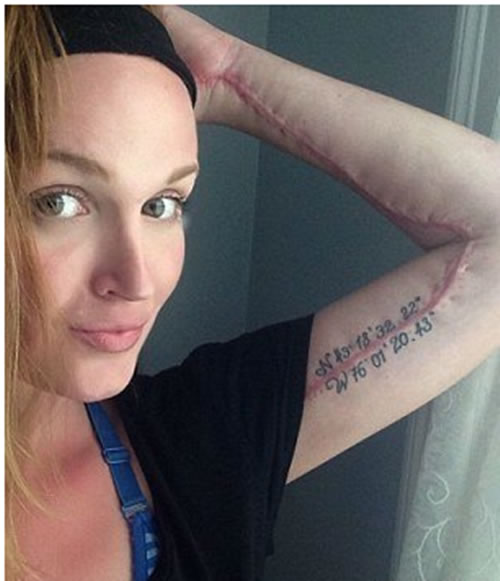 手有小块红肿隔天竟被吃掉一半（图文）