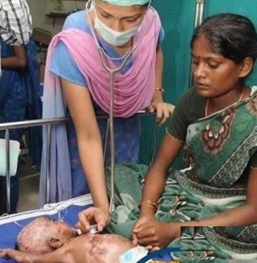 三月男婴身体无故自燃医生无解（图）