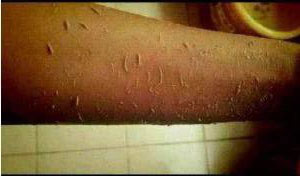 从你身上搓下来的泥竟是这东西（图）