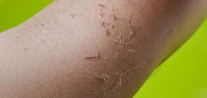 从你身上搓下来的泥竟是这东西（图）