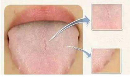 从你身上搓下来的泥竟是这东西（图）