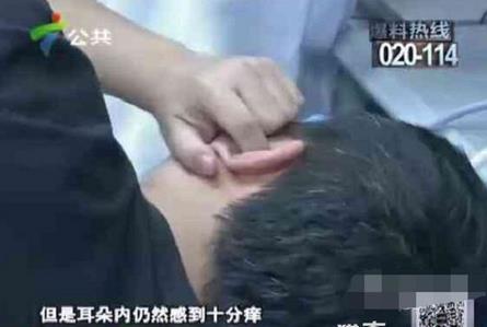 男子耳朵奇痒无比里面竟有这个(图) 男子耳朵奇痒无比里面竟有这个(图)