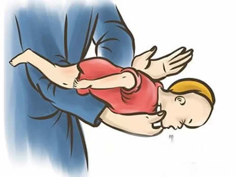 吃饭鱼刺卡喉咙怎么办 教你海姆立克急救法(全文) 吃饭鱼刺卡喉咙怎么办 教你海姆立克急救法(全文)